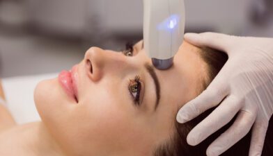 Laser Treatment
